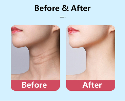 الجهاز التجميلي الميكروكورنت للوجه EMS الرقبة رفع الوجه ماساجر متعددة الوظائف معدات الجمال